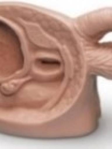 Modelo Cateterismo Masculino