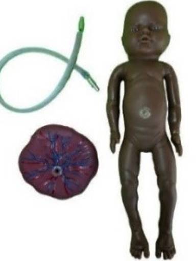 Beb RN - Cordo Umbilical e Placenta